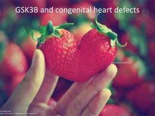 GSK3B and congenital heart defects