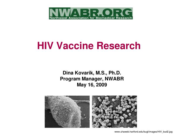 hiv vaccine research