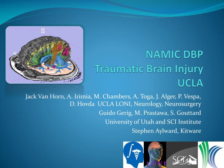 namic dbp traumatic brain injury ucla