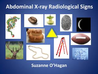 Abdominal X-ray Radiological Signs
