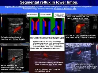 Segmental reflux in lower limbs .