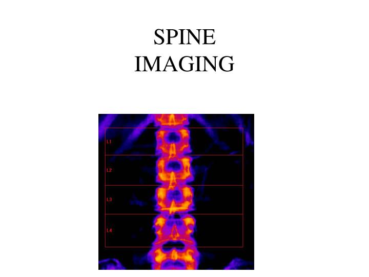 spine imaging