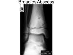 Broadies Abscess - slide 1