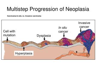 Multistep Progression of Neoplasia