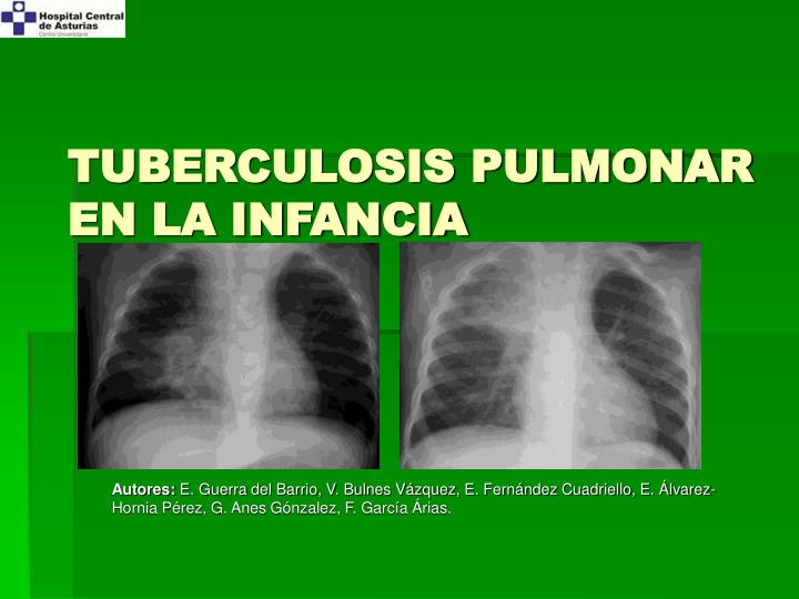 tuberculosis pulmonar en la infancia