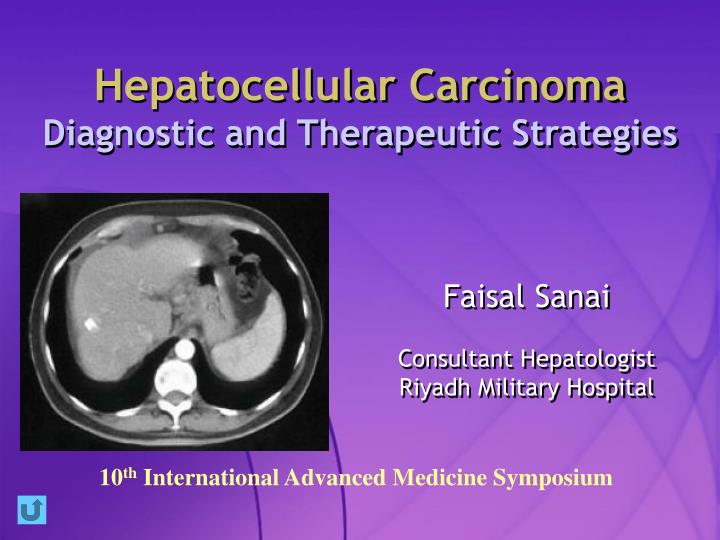 hepatocellular carcinoma diagnostic and therapeutic strategies