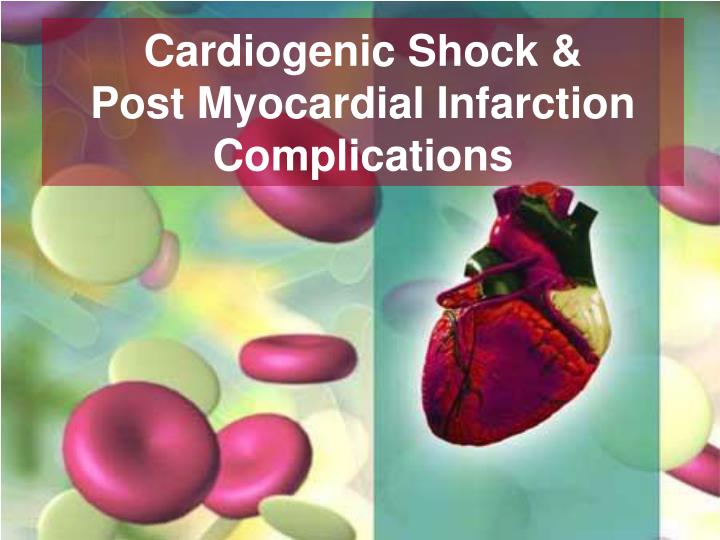 cardiogenic shock post myocardial infarction complications