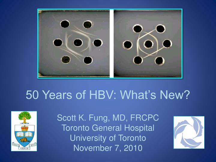 50 years of hbv what s new