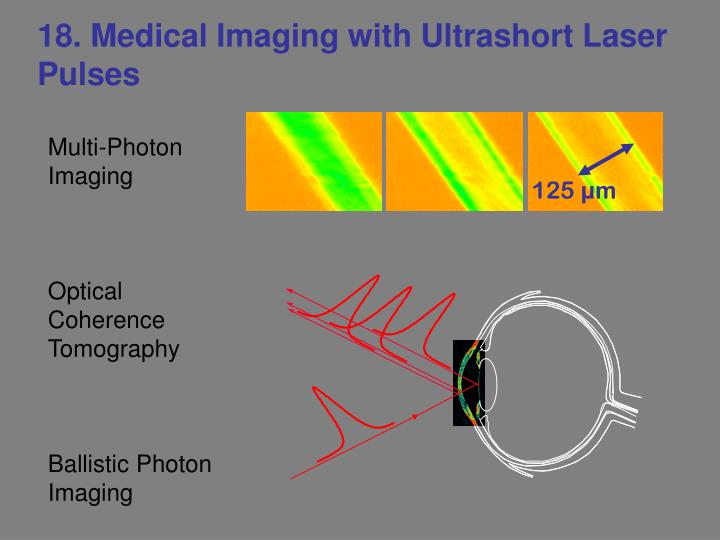 18 medical imaging with ultrashort laser pulses