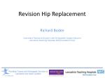 Revision Hip Replacement - slide 1