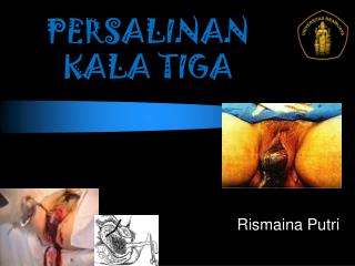 persalinan kala tiga