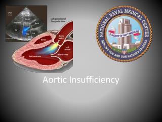 Aortic Insufficiency