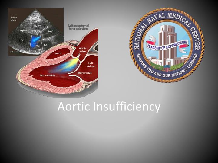 aortic insufficiency