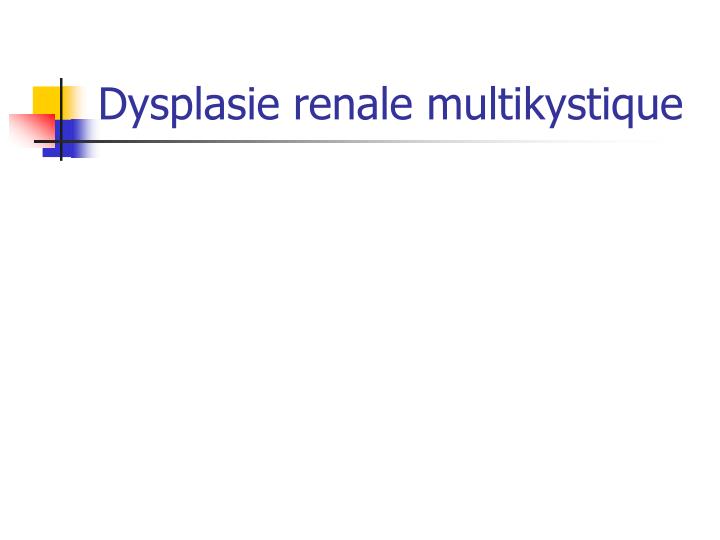 dysplasie renale multikystique