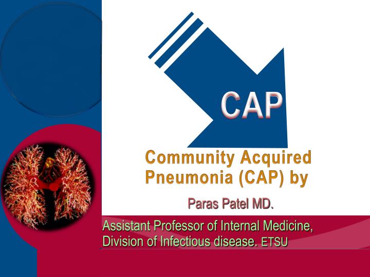 community acquired pneumonia cap by