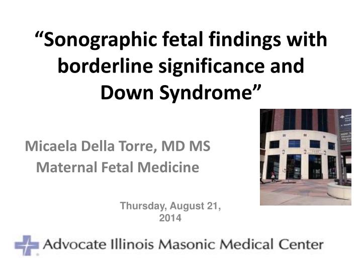sonographic fetal findings with borderline significance and down syndrome