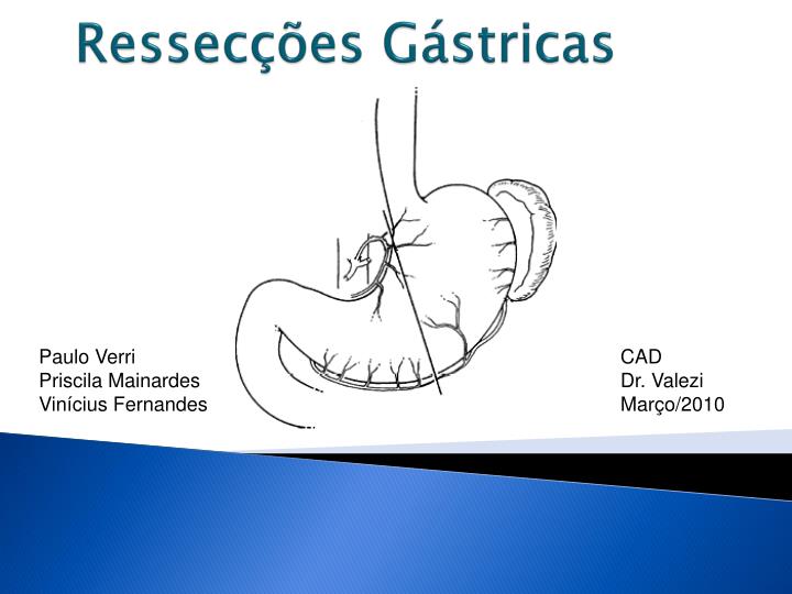 ressec es g stricas