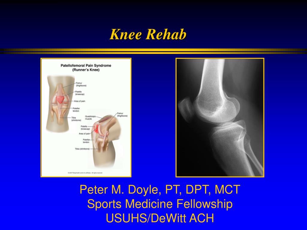 PPT - Knee Rehab PowerPoint Presentation, free download - ID:3391356