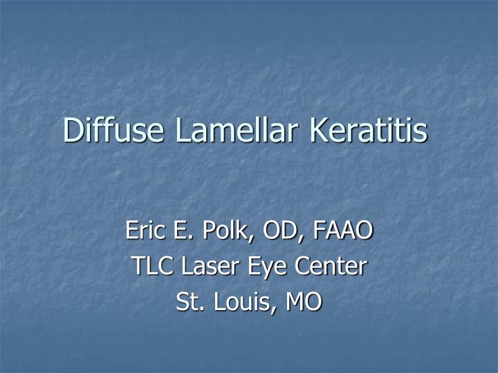 diffuse lamellar keratitis