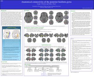 Anatomical connectivity of the posterior fusiform gyrus Joseph. T. Devlin 1 and Cathy J. Price 2