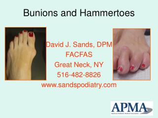Bunions and Hammertoes