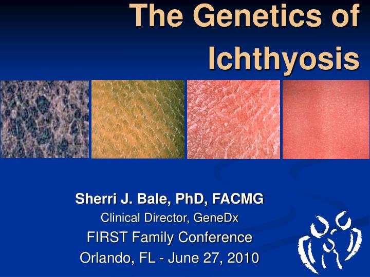 the genetics of ichthyosis