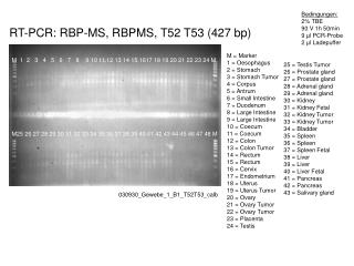 RT-PCR: RBP-MS, RBPMS , T52 T53 (427 bp)
