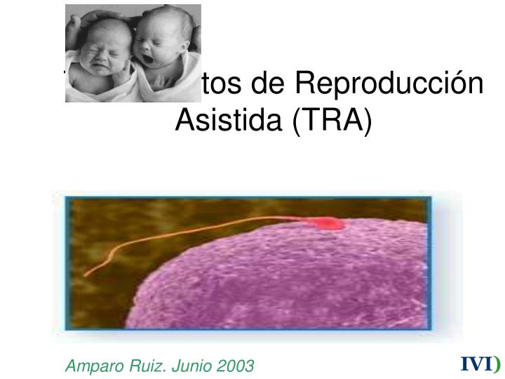 tratamientos de reproducci n asistida tra