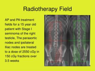 Radiotherapy Field