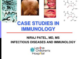 CASE STUDIES IN IMMUNOLOGY