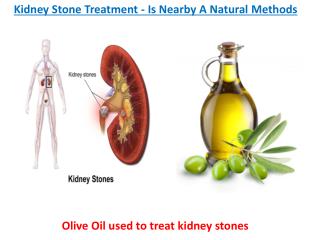 Kidney Stone Treatment - Is Nearby A Natural Methods