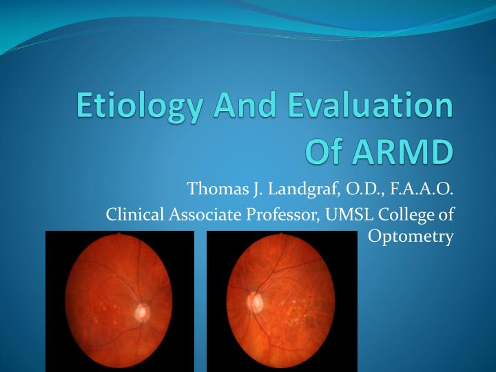 etiology and evaluation of armd