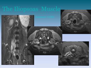 The Iliopsoas Muscle