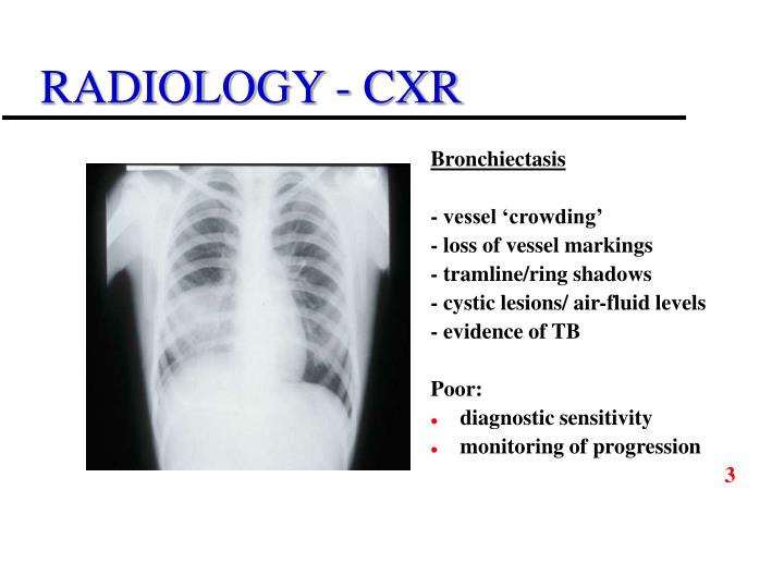 radiology cxr