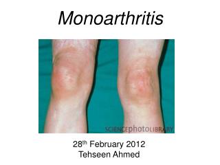 Monoarthritis
