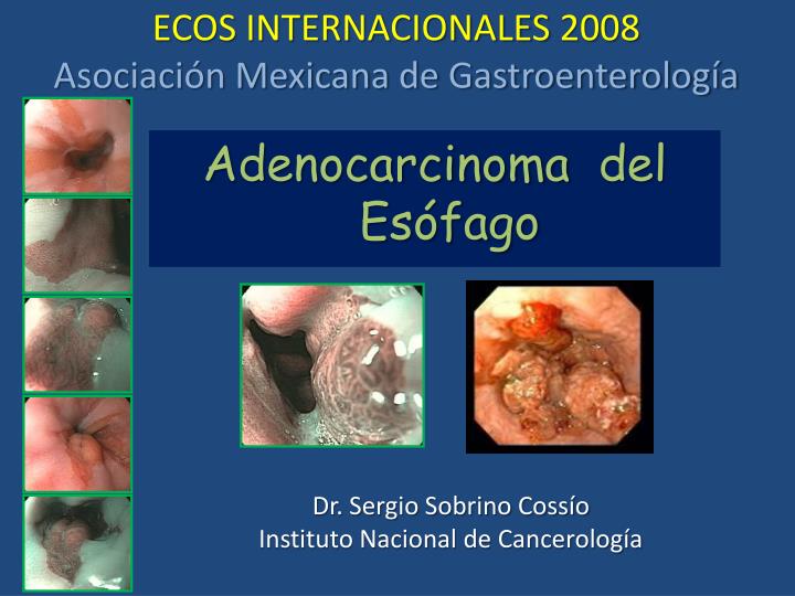 ecos internacionales 2008 asociaci n mexicana de gastroenterolog a