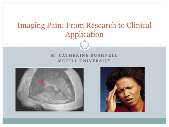 imaging pain from research to clinical application