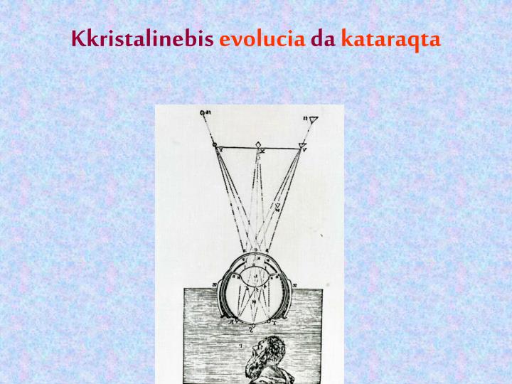 kkristalinebis evolucia da kataraqta