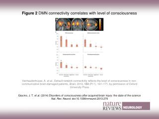 Figure 2 DMN connectivity correlates with level of consciousness