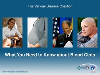 What You Need to Know about Blood Clots