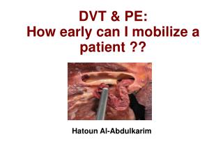 DVT &amp; PE: How early can I mobilize a patient ??