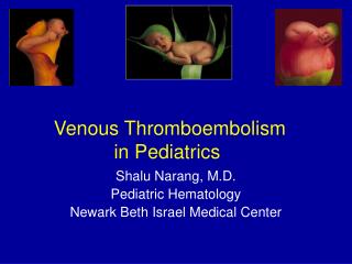 Venous Thromboembolism in Pediatrics