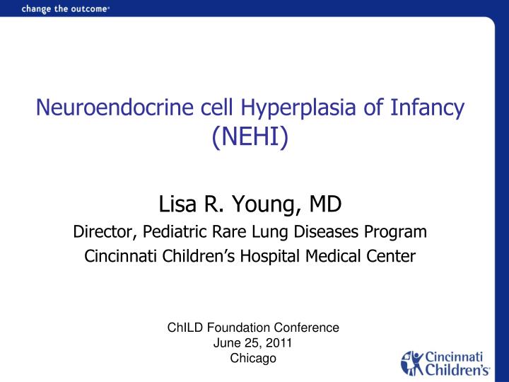 neuroendocrine cell hyperplasia of infancy nehi