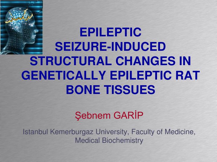 epileptic seizure induced structural changes in genetically epileptic rat bone tissues