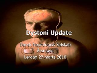 dystoni update
