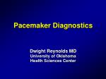 Pacemaker Diagnostics