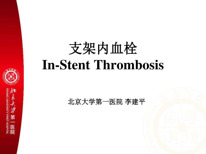 in stent thrombosis
