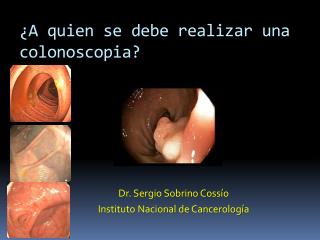 a quien se debe realizar una colonoscopia