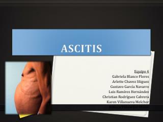 ascitis