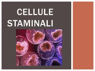 cellule staminali